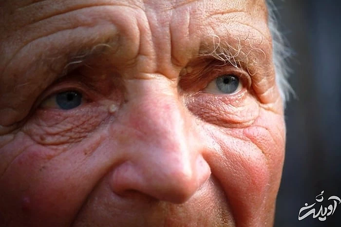 نشانه پیر شدن